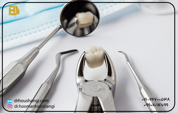 انواع جراحی های دندان آلوئول