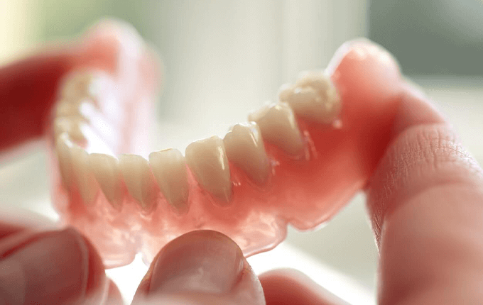 تفاوت ایمپلنت و دندان مصنوعی
