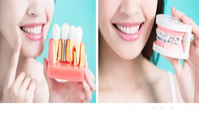 چرا باید قبل یا بعد ایمپلنت دندان ارتودنسی انجام داد؟