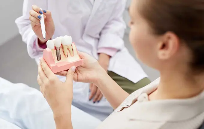 7 مورد از عوارض ایمپلنت دندان
