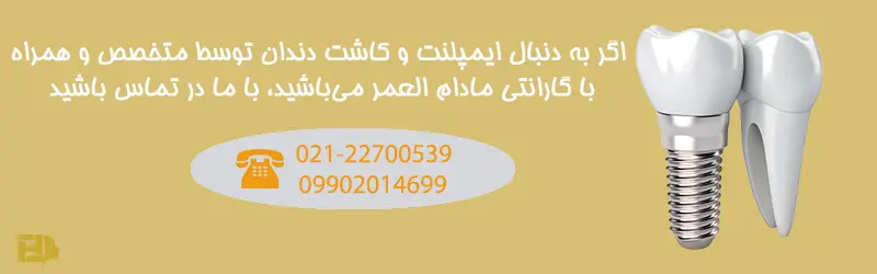 مزایای ایمپلنت دندان چیست؟
