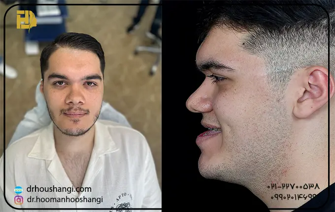 هدف از جراحی ارتوگناتیک یا فک و صورت چیست؟