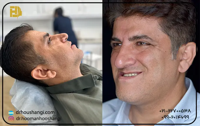 هدف از جراحی ارتوگناتیک یا فک و صورت چیست؟