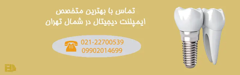 ایمپلنت دیجیتال چیست؟ بررسی مزایا و معایب آن
