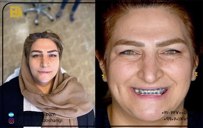 هزینه جراحی فک و صورت در شمال تهران