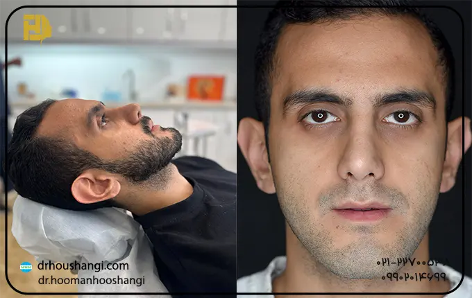بهترین متخصص فک و صورت در شمال تهران ( زعفرانیه )