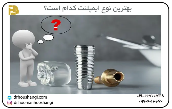 طریقه شناخت و انجام بهترین ایمپلنت