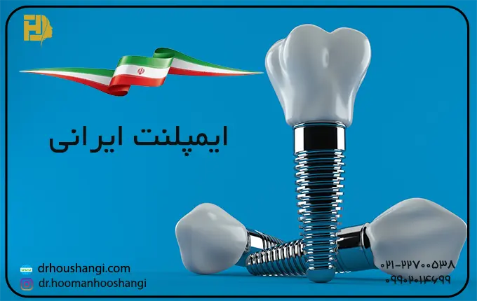 آیا ایمپلنت ایرانی خوب است؟